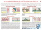 Плакат "Оказание первой помощи при ранениях и переломах" А2